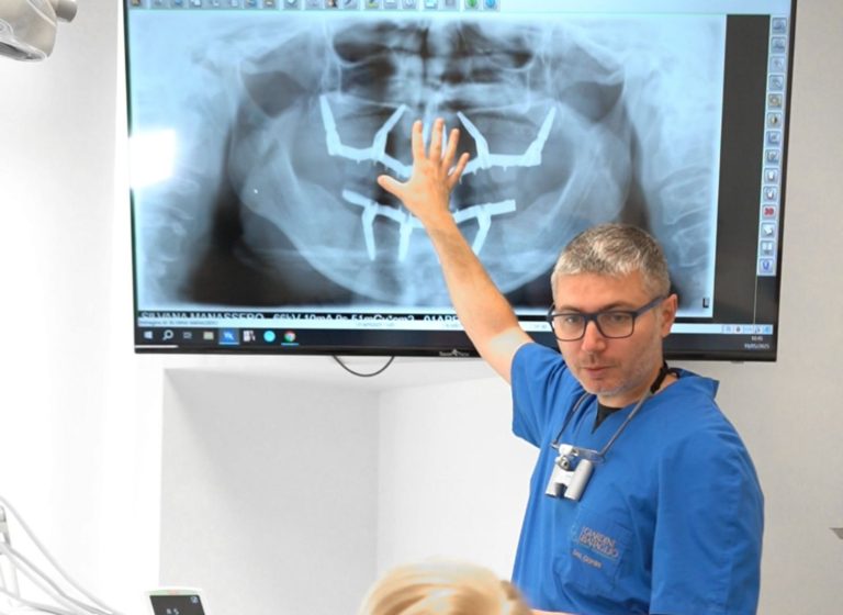 Blog 1 Quanto dura un impianto dentale?