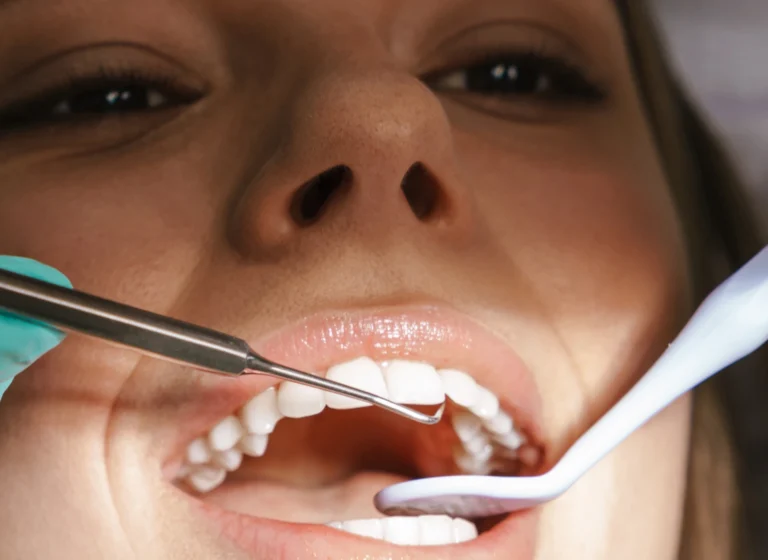 Ogni quanto fare la pulizia dentale