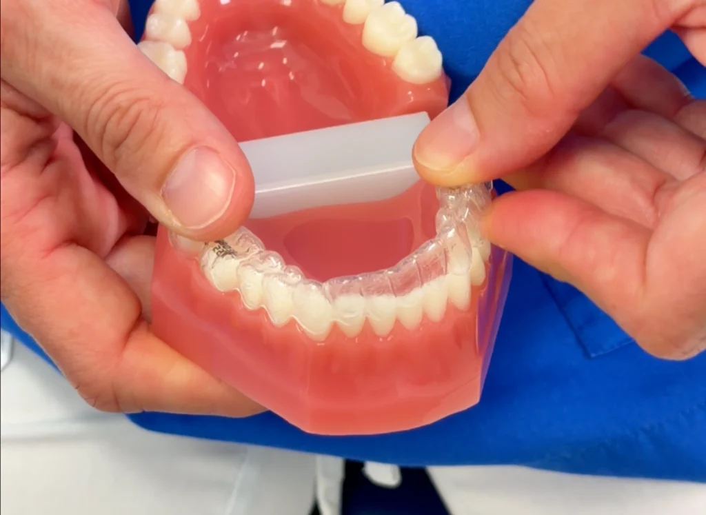 Quanto è visibile un apparecchio trasparente 1 Quanto è visibile un apparecchio trasparente